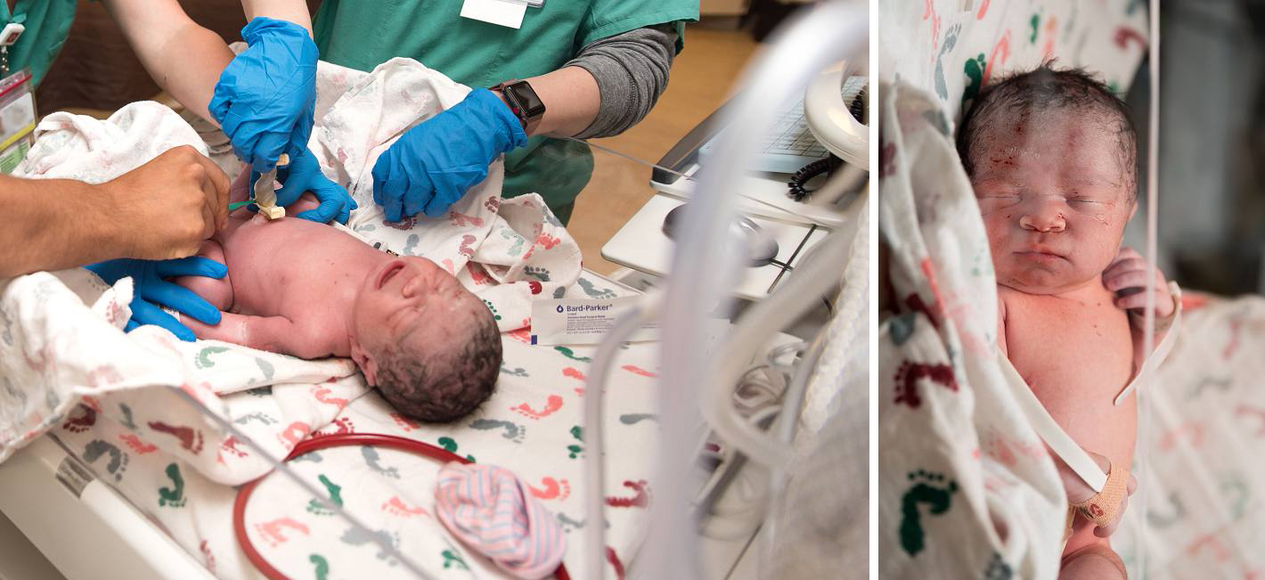 Dad cutting the cord in incubator, cesarean birth Denver