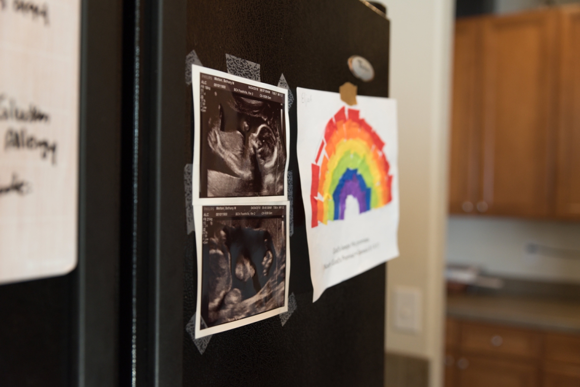Rainbow baby sonogram